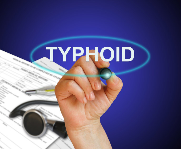 Fièvre typhoïde